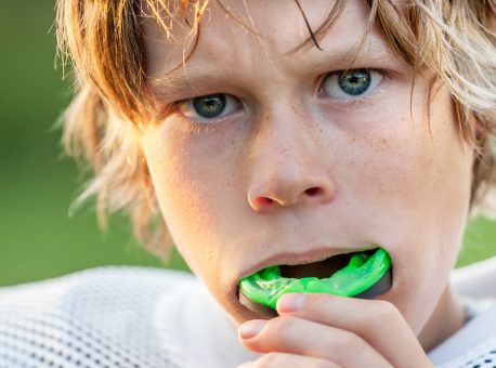 How to Protect Your Teeth During Sports: Mouthguards and More