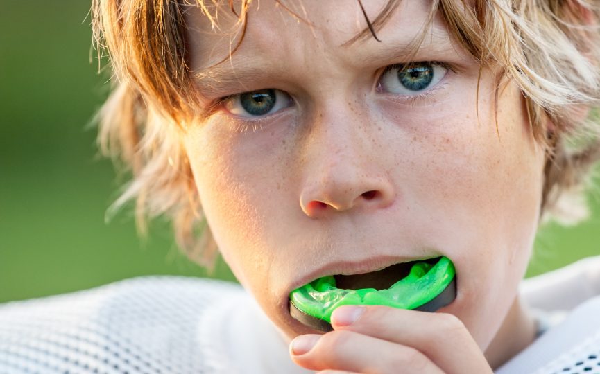 How to Protect Your Teeth During Sports: Mouthguards and More