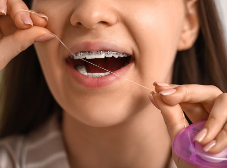 What Are Effective Techniques for Flossing with Braces?